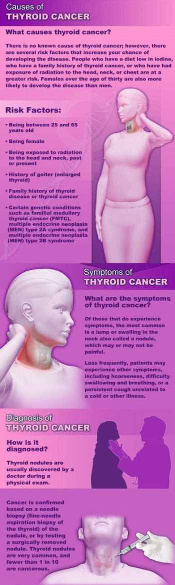 celebrities with thyroid cancer - educational material2